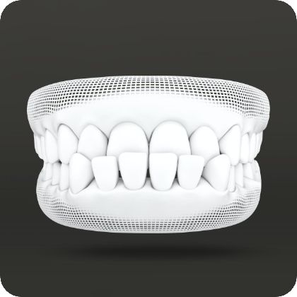 Bite alignment model